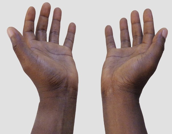 APM - Allégories Portes-Maison - 